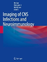 Book Cover for Imaging of CNS Infections and Neuroimmunology by Bo Gao