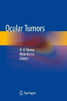 Book Cover for Ocular Tumors by H. V. Nema