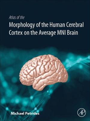 Atlas of the Morphology of the Human Cerebral Cortex on the Average MNI Brain