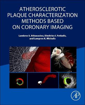 Atherosclerotic Plaque Characterization Methods Based on Coronary Imaging