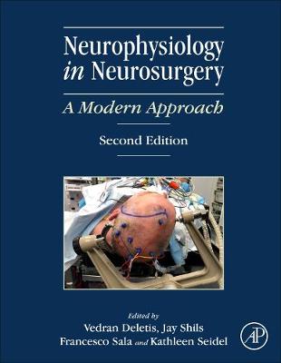 Neurophysiology in Neurosurgery