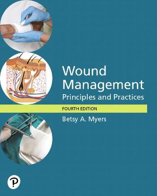 Wound Management