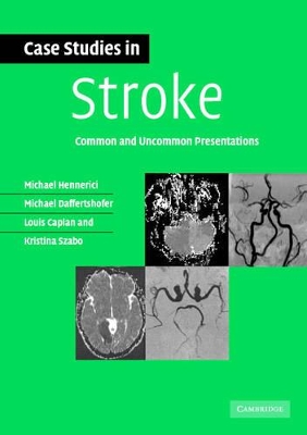 Case Studies in Stroke