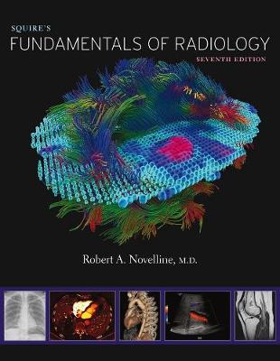 Squire’s Fundamentals of Radiology