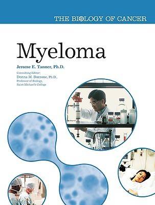 Myeloma