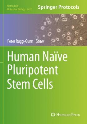 Human Naïve Pluripotent Stem Cells