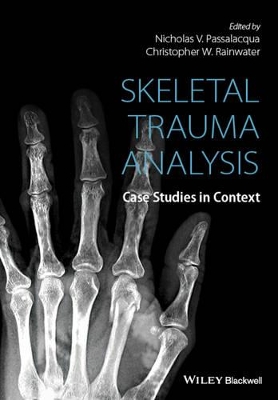 Skeletal Trauma Analysis