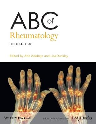 ABC of Rheumatology