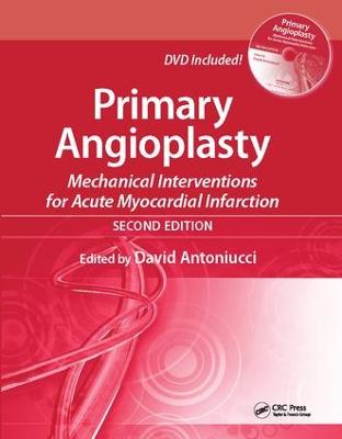 Primary Angioplasty