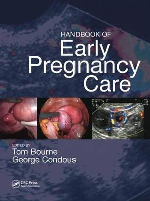 Handbook of Early Pregnancy Care