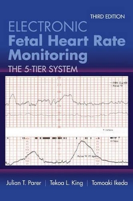 Electronic Fetal Heart Rate Monitoring