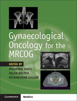 Gynaecological Oncology for the MRCOG