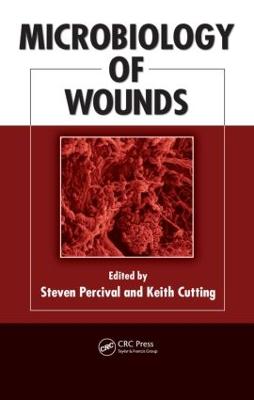 Microbiology of Wounds