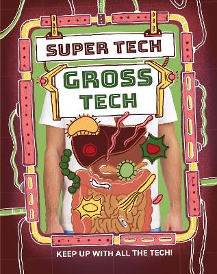 Super Tech: Gross Tech