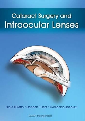 Cataract Surgery and Intraocular Lenses