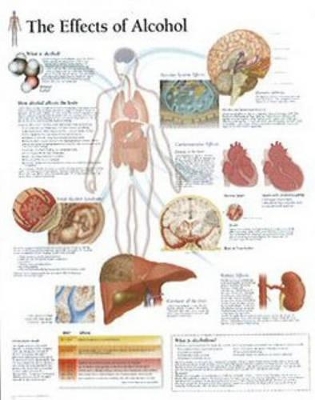 Effects of Alcohol Paper Poster