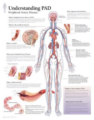 Understanding PAD Laminated Poster