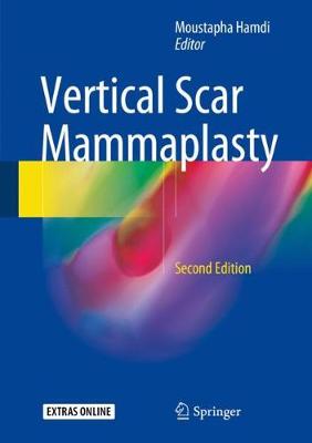 Vertical Scar Mammaplasty