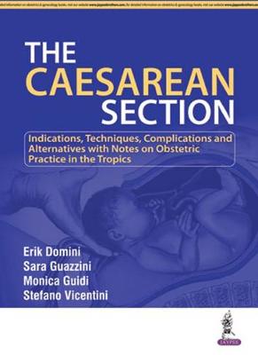 The Caesarean Section