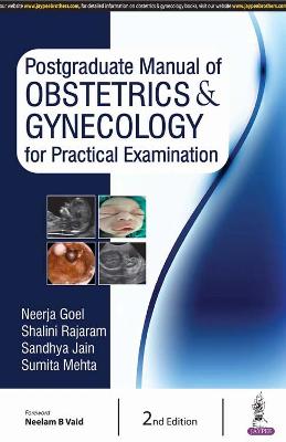 Postgraduate Manual of Obstetrics & Gynecology for Practical Examination