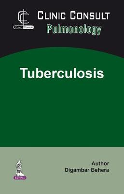 Clinic Consult Pulmonology: Tuberculosis