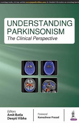 Understanding Parkinsonism