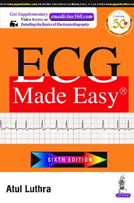 ECG Made Easy