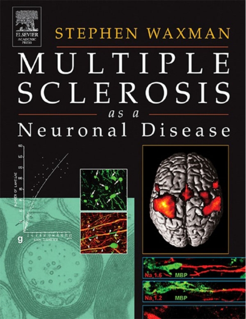 Book Cover for Multiple Sclerosis As A Neuronal Disease by Stephen Waxman