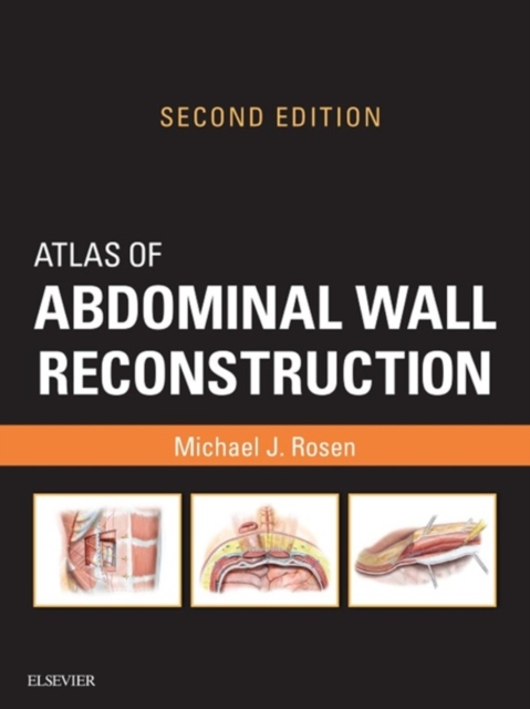 Book Cover for Atlas of Abdominal Wall Reconstruction E-Book by Michael J. Rosen