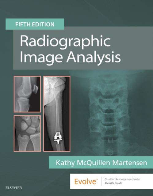 Book Cover for Radiographic Image Analysis E-Book by McQuillen-Martensen, Kathy