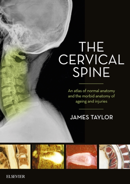 Book Cover for Cervical Spine by James Taylor