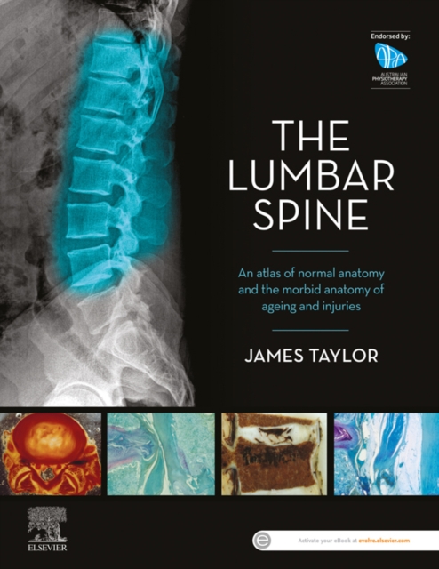Book Cover for Lumbar Spine by James Taylor