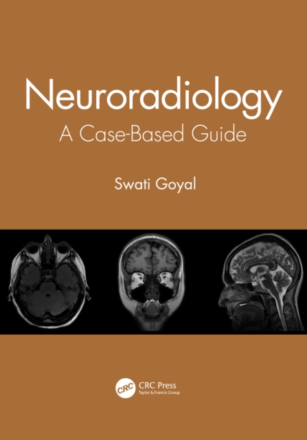 Book Cover for Neuroradiology by Swati Goyal