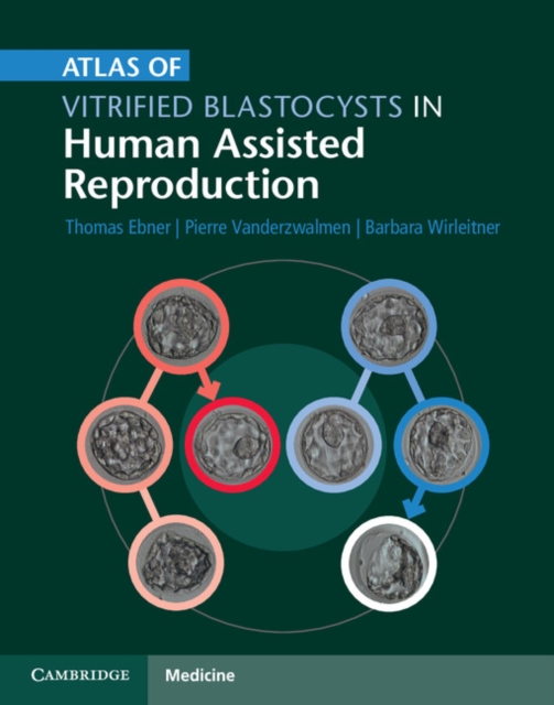 Book Cover for Atlas of Vitrified Blastocysts in Human Assisted Reproduction by Thomas Ebner, Pierre Vanderzwalmen, Barbara Wirleitner