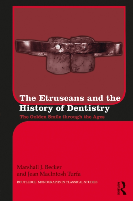 Book Cover for Etruscans and the History of Dentistry by Becker, Marshall J.|Turfa, Jean MacIntosh