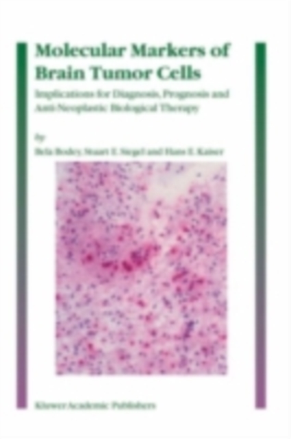 Book Cover for Molecular Markers of Brain Tumor Cells by Bela Bodey, Stuart E. Siegel, Hans E. Kaiser