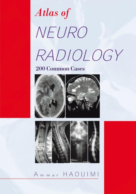 Book Cover for Atlas of Neuroradiology by Ammar Haouimi