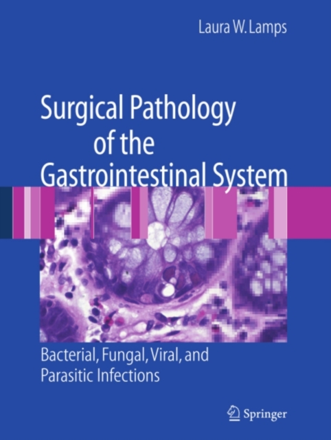 Book Cover for Surgical Pathology of the Gastrointestinal System: Bacterial, Fungal, Viral, and Parasitic Infections by Laura W. Lamps