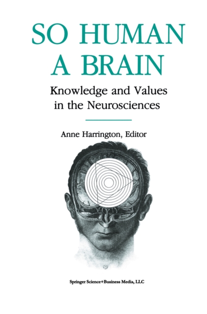 Book Cover for So Human a Brain by HARRINGTON