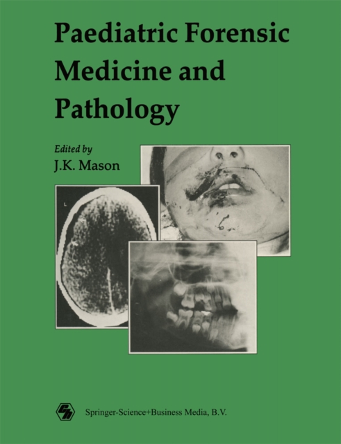 Book Cover for Paediatric Forensic Medicine and Pathology by J. K. Mason