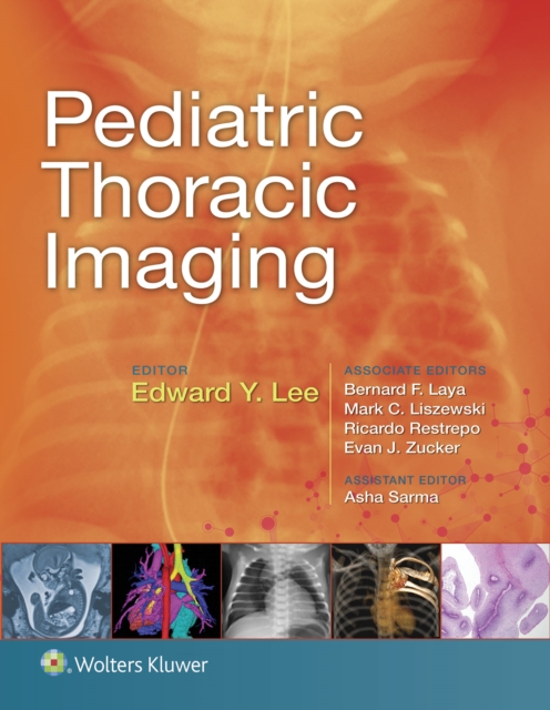 Book Cover for Pediatric Thoracic Imaging by Edward Y. Lee