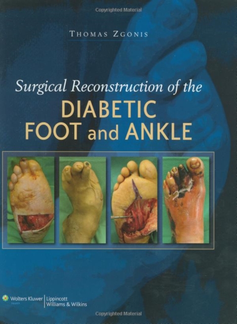 Book Cover for Surgical Reconstruction of the Diabetic Foot and Ankle by Thomas Zgonis