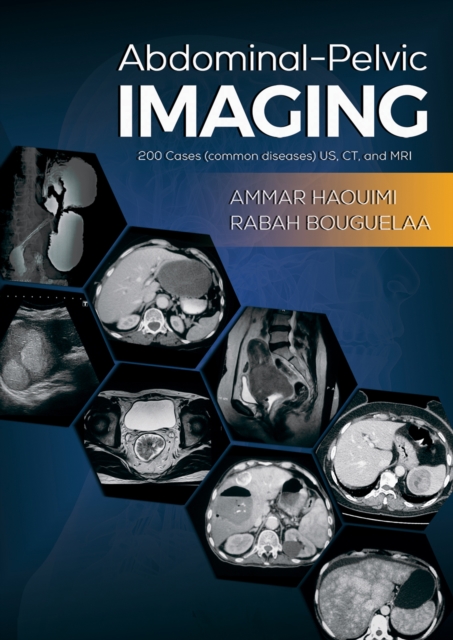 Book Cover for Abdominal-Pelvic Imaging by Ammar Haouimi