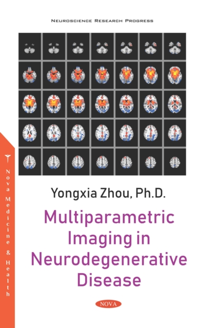 Book Cover for Multiparametric Imaging in Neurodegenerative Disease by Yongxia Zhou