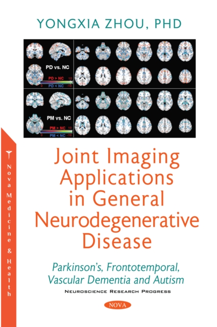 Book Cover for Joint Imaging Applications in General Neurodegenerative Disease by Yongxia Zhou