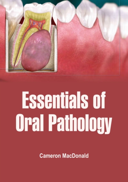 Book Cover for Essentials of Oral Pathology by Cameron MacDonald