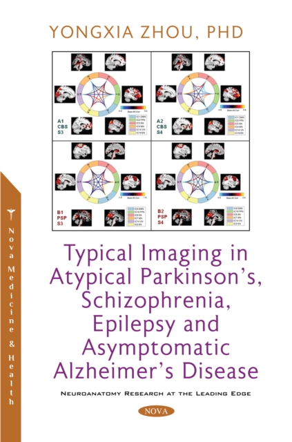 Book Cover for Typical Imaging in Atypical Parkinson's, Schizophrenia, Epilepsy and Asymptomatic Alzheimer's Disease by Yongxia Zhou