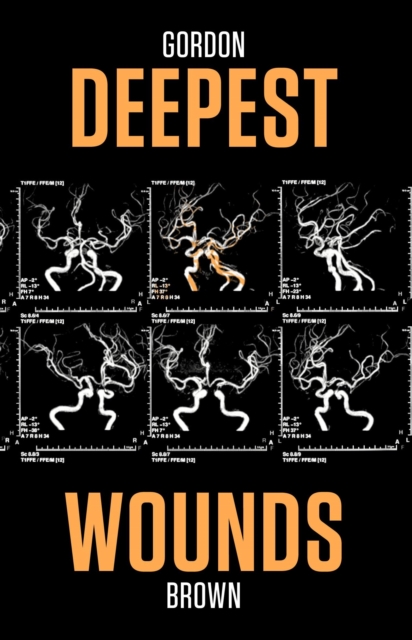 Book Cover for Deepest Wounds by Gordon