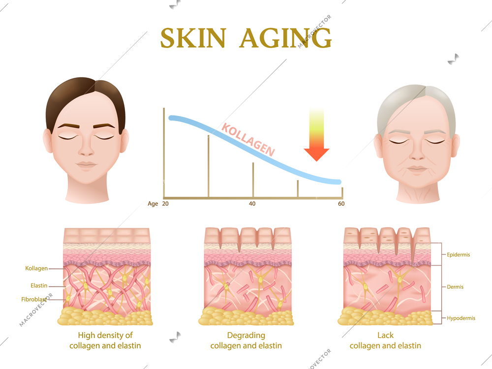 Skin aging process anatomy of layers during decrease of collagen level realistic infographics vector illustration