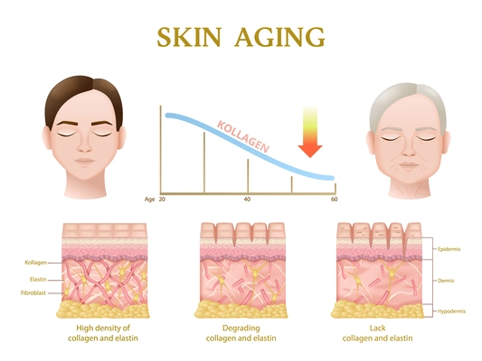 Skin aging process anatomy of layers during decrease of collagen level realistic infographics vector illustration